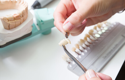 精度を左右する歯型採取と修復物の違い