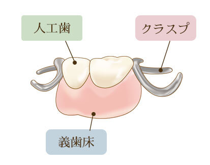 入れ歯の構造