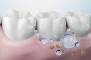 お口を清潔に保つ