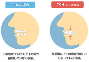 歯の接触時間