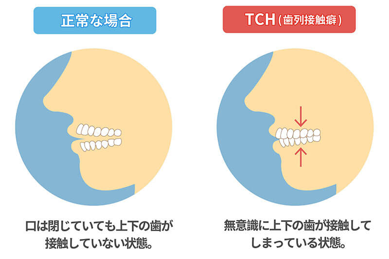 歯の接触時間