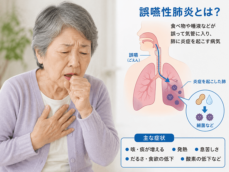 誤嚥性肺炎について